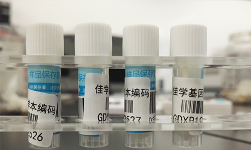 【佳學(xué)基因檢測(cè)】做Bosch-Boonstra-Schaaf視神經(jīng)萎縮綜合征基因解碼、<a href=http://www.alivewithwords.com/tk/jiema/cexujishu/2021/31933.html>基因檢測(cè)</a>需要多長(zhǎng)時(shí)間？