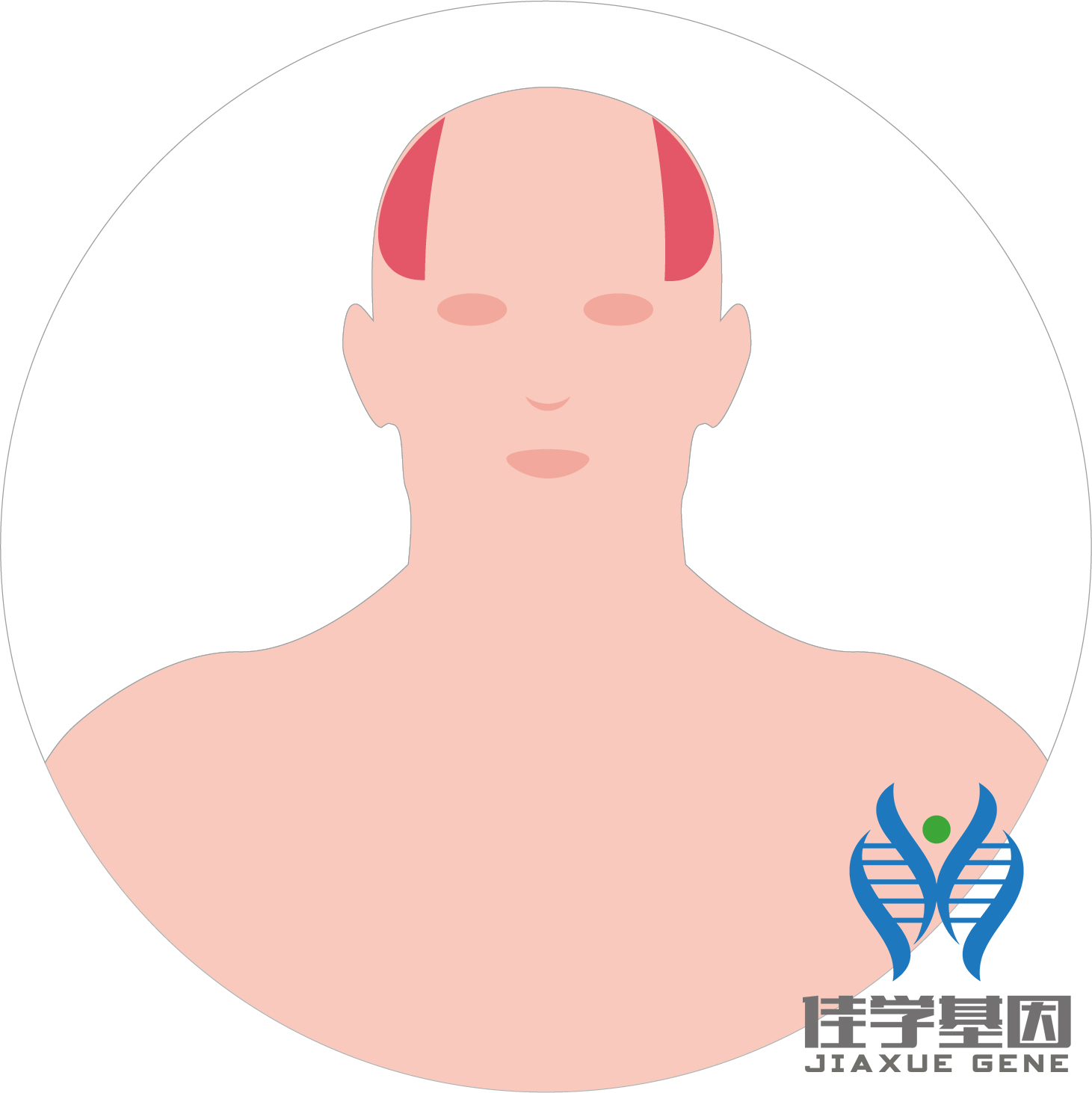 【佳學(xué)基因檢測】男性<font color='red'>脫發(fā)</font>（Androgenetic alopecia）基因解碼、<a href=http://www.alivewithwords.com/tk/jiema/cexujishu/2021/31933.html>基因檢測</a>